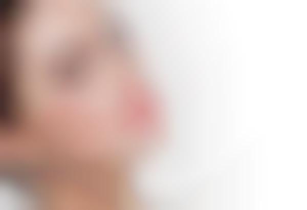 Rosacea-Specific Skincare