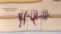 Genius Color Changing Sutures Image 2