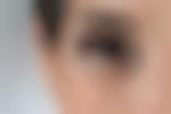 Natural Botox Alternatives