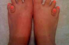 Freaky Feet Contests
