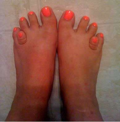 Freaky Feet Contests