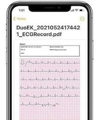 Portable Heart-Monitoring Devices Image 2