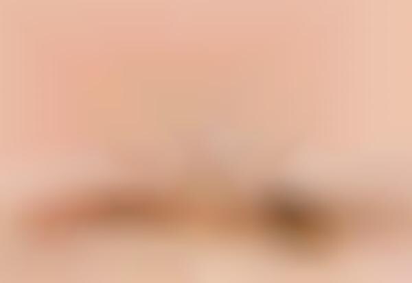 Eye Bag-Reducing Extracts