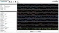 AI-Enabled Sleep Disorder Tools Image 2