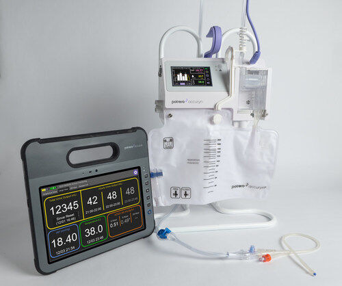 Revolutionary Kidney Monitors