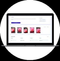 AI-Enabled Cervical Cancer Screeners Image 3