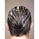 Affordable Scalp Care Solutions Image 1
