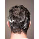 Affordable Scalp Care Solutions Image 3
