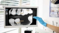 AI-Powered Dental X-Rays Image 1