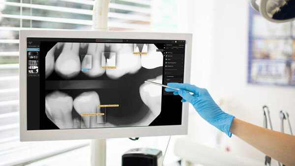 AI-Powered Dental X-Rays