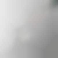 Needle-Free Filler Alternatives Image 1