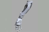 AI-Powered Prosthetic Arms Image 8