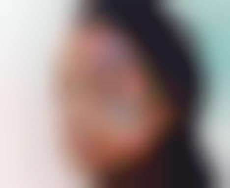AI-Informed Skincare