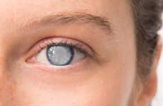 Cataract-Clearing Treatments