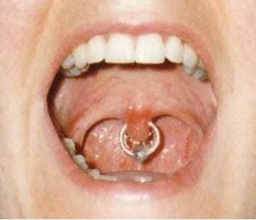 19 Peculiar Piercings