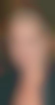 Completely Hairless Faces