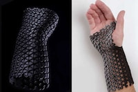 Recycled Material Medical Casts