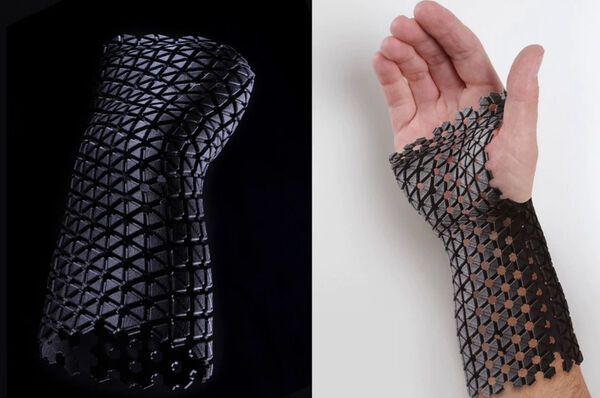 Recycled Material Medical Casts