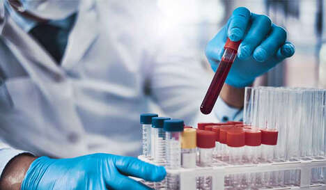 Neurodegenerative Disease Tests