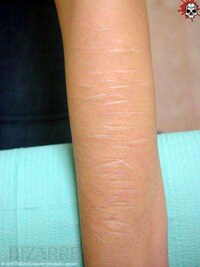 Creative Scar Cover Ups Image 3