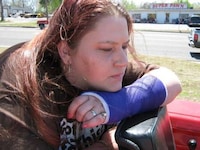Capitalizing on Injuries Image 3