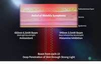 Tech-Powered Nasal Therapy Wearables Image 6