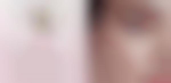 Over-Reactive Skin Serums