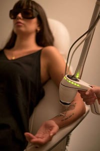 Gentle Tattoo Removal Services Image 2