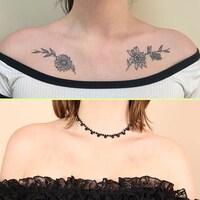 Gentle Tattoo Removal Services Image 3