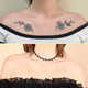 Gentle Tattoo Removal Services Image 3