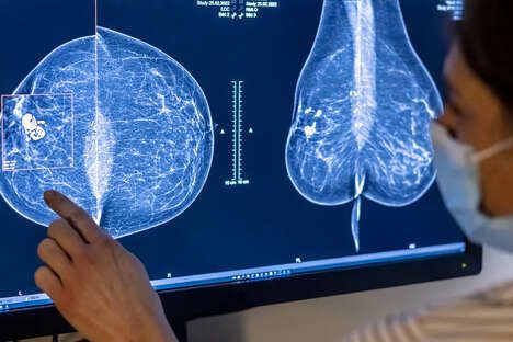 AI-Breast Cancer Screening Tools