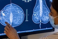 AI-Breast Cancer Screening Tools Image 1