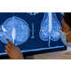 AI-Breast Cancer Screening Tools Image 1
