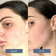 Daily Hygiene Facial Sprays Image 2