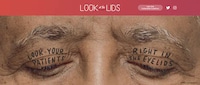 Eyelid Health Campaigns Image 1