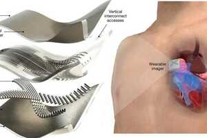 Advanced Heart-Tracking Patches: This Wearable Ultrasound Patch ...