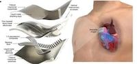 Advanced Heart-Tracking Patches