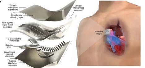 Wearable Ultrasound Patches