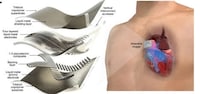 Wearable Ultrasound Patches Image 1