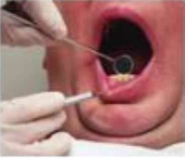 25 Ways to Clean Your Teeth