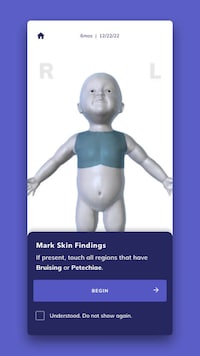 Plausible Abuse Assessment Apps Image 2