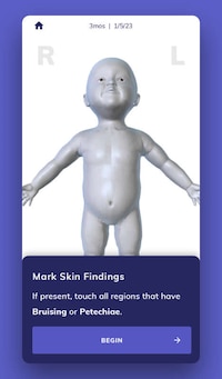 Plausible Abuse Assessment Apps Image 4