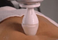 Back-Targeting Massage Robots Image 2