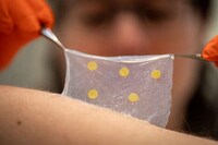 Color-Changing Wound Dressings