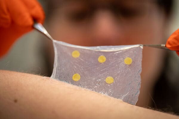 Color-Changing Wound Dressings
