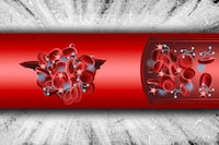 Clot-Inducing Synthetic Injectables