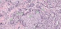 AI Mitosis Detectors