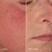 Skin Barrier-Protecting Creams Image 2