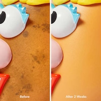 Potato-Infused Skincare Peels Image 4