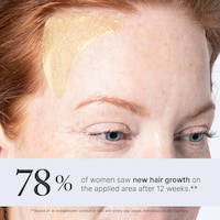 Thickening Hair Patches